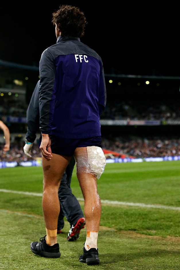 AFL 2017 Round 20 - Fremantle v Gold Coast Docker Brady Grey nursing a hamstring injury - AFL,Injuries